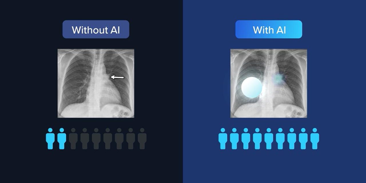 Artificial Intelligence and Chest X-Rays: Researchers from YULCOM, Concordia University, and McGill University Publish New Research on Lung Disease Classification
